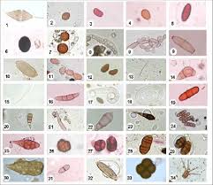 Attēlu rezultāti vaicājumam “Comatricha elegans var. microspora spores”