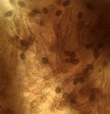 Attēlu rezultāti vaicājumam “Melanospora lagenaria”