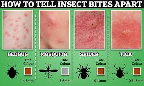 Image result for bed bug bites