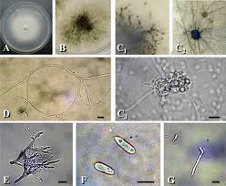 Attēlu rezultāti vaicājumam “Badhamiopsis macrospora spores”