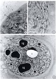 Attēlu rezultāti vaicājumam “Nostoc pruniforme cells”