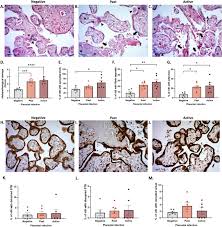 Attēlu rezultāti vaicājumam “Enteridium variabile plasmodium”