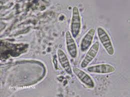 Attēlu rezultāti vaicājumam “Opegrapha atra”