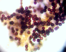 Attēlu rezultāti vaicājumam “Physarum pseudoalexandrowiczii spores”