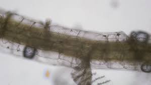 Attēlu rezultāti vaicājumam “Physarum penetrale stalked”