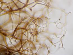 Attēlu rezultāti vaicājumam “Lamproderma pseudomaculatum spores”