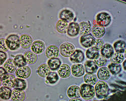 Attēlu rezultāti vaicājumam “Heterotrichia obvelata (syn. Arcyria obvelata) macro”