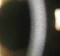 the corneal <b>endothelium</b> OU
