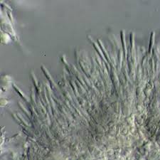 Attēlu rezultāti vaicājumam “Porpidia macrocarpa”