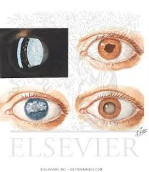 Attēlu rezultāti vaicājumam “Reticularia jurana young”