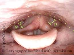 Attēlu rezultāti vaicājumam “Cribraria piriformis”