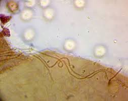 Attēlu rezultāti vaicājumam “Dianema depressum spores”