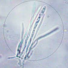 Attēlu rezultāti vaicājumam “Chlorociboria aeruginascens”