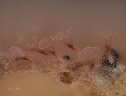 Attēlu rezultāti vaicājumam “Arcyria affinis stalked”