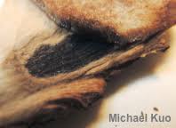 Attēlu rezultāti vaicājumam “Ischnoderma benzoinum”