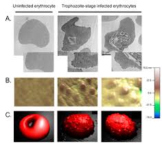 Attēlu rezultāti vaicājumam “Enteridium variabile plasmodium”