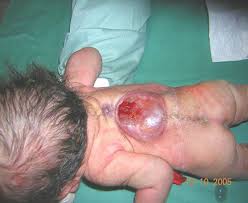 http://t0.gstatic.com/images?q=tbn:ANd9GcTxzaAfw3Qcn5f-GrQemCQhspzfUfgu8ulKq8bIERRtoDQwgO2u