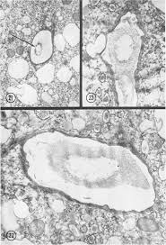 Attēlu rezultāti vaicājumam “Stemonitis virginiensis spores”