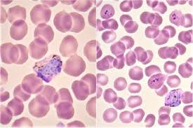 Attēlu rezultāti vaicājumam “Enteridium variabile plasmodium”