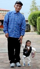 Image result for Nanismo Primordial