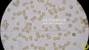 Attēlu rezultāti vaicājumam “Cribraria argillacea spores”