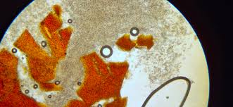 Attēlu rezultāti vaicājumam “Nectria sp., Neonectria sp.”