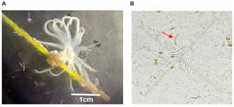 Attēlu rezultāti vaicājumam “Urocystis anemones spores”