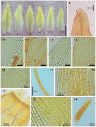 Attēlu rezultāti vaicājumam “Orthotrichum diaphanum sporophyte”