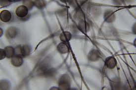 Attēlu rezultāti vaicājumam “Diderma chondrioderma sessile”