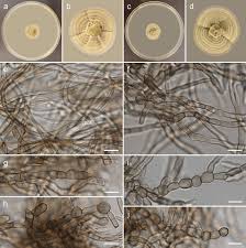 Attēlu rezultāti vaicājumam “Colloderma oculatum spores”