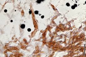 Attēlu rezultāti vaicājumam “Melanospora lagenaria”