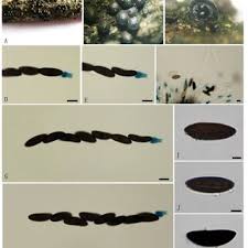 Attēlu rezultāti vaicājumam “Rosellinia desmazieri spores”