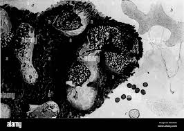 Attēlu rezultāti vaicājumam “Physarum diderma”