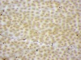 Attēlu rezultāti vaicājumam “Podostroma leucopus”