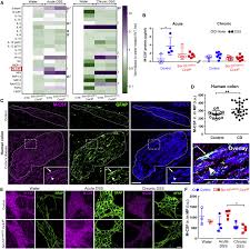 Attēlu rezultāti vaicājumam “Enteridium variabile macro”