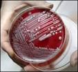 Acinetobacter Baumannii in Iraq
