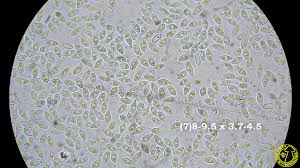 Attēlu rezultāti vaicājumam “Ascotremella faginea”
