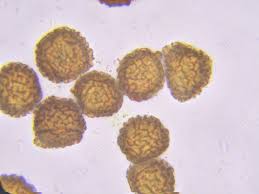 Attēlu rezultāti vaicājumam “Fossombronia wondraczekii spores”