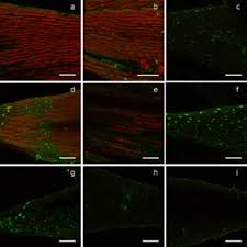 Attēlu rezultāti vaicājumam “Schistidium apocarpum stalked”