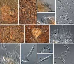 Attēlu rezultāti vaicājumam “Mycosphaerella ulmi”