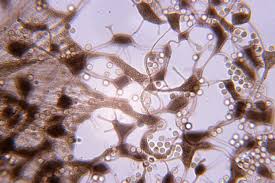 Attēlu rezultāti vaicājumam “Cribraria aurantiaca”