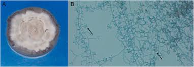 Attēlu rezultāti vaicājumam “Schistidium dupretii sporophyte”