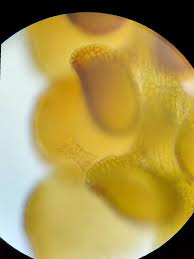 Attēlu rezultāti vaicājumam “Frullania fragilifolia macro”