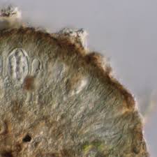 Attēlu rezultāti vaicājumam “Arthonia byssacea”