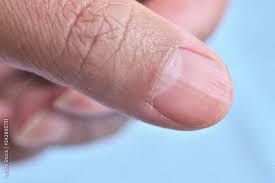 Image result for lunula nail