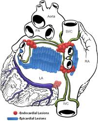 Image result for Meir Heath Cc