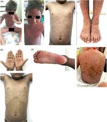 Attēlu rezultāti vaicājumam “Diderma subviridifuscum var. macrospora* young”