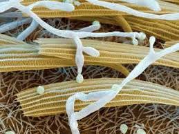 Attēlu rezultāti vaicājumam “Badhamiopsis praetermissa spores”