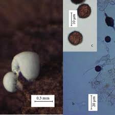 Attēlu rezultāti vaicājumam “Didymium verrucisporum spores”