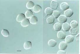 Attēlu rezultāti vaicājumam “Puccinia coronata”